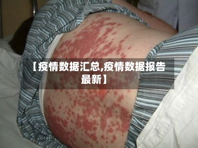 【疫情数据汇总,疫情数据报告最新】-第2张图片