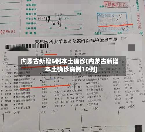 内蒙古新增6例本土确诊(内蒙古新增本土确诊病例10例)-第2张图片
